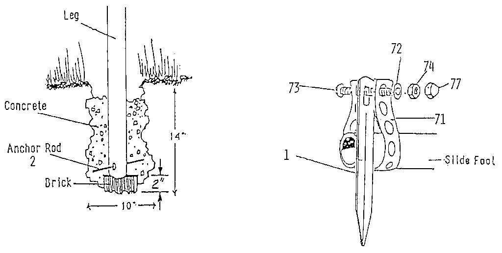 Anchor assembly