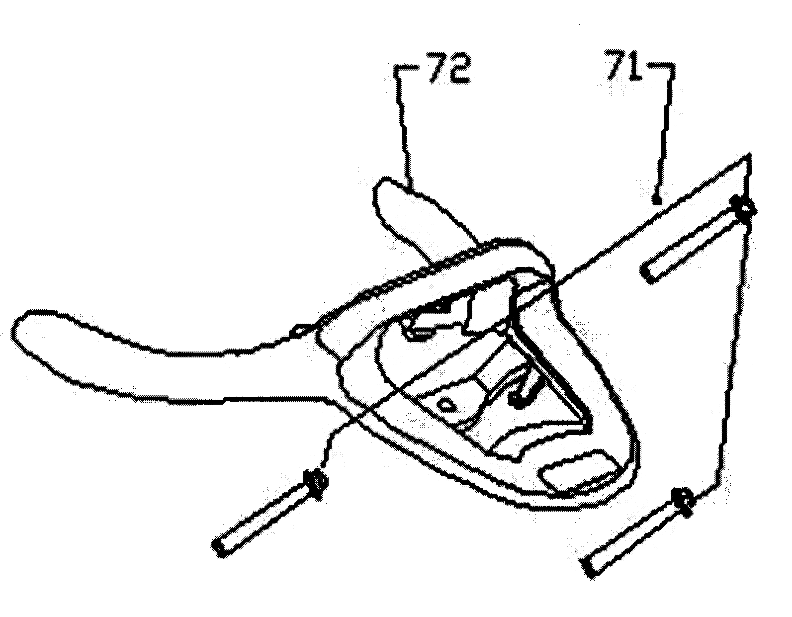 Rear handle