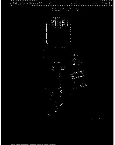 Statr,rotor,relay,cptr,bell (fc6,11,21) (fc21) (fc11) (fc6)